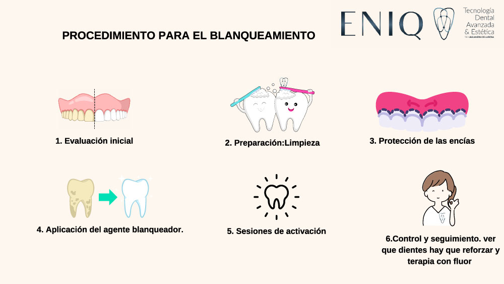 Procedimiento para el blanqueamiento dental