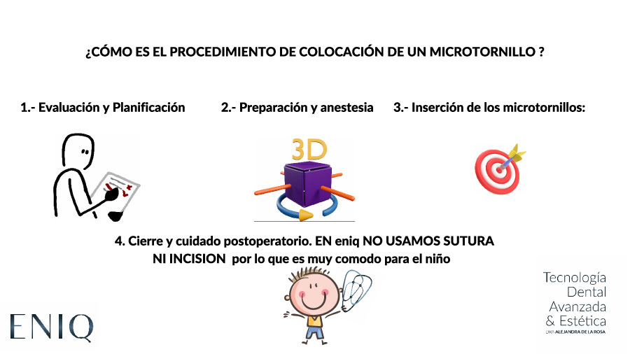 Explicación del proceso la colocación de microtornillos en ortodoncia