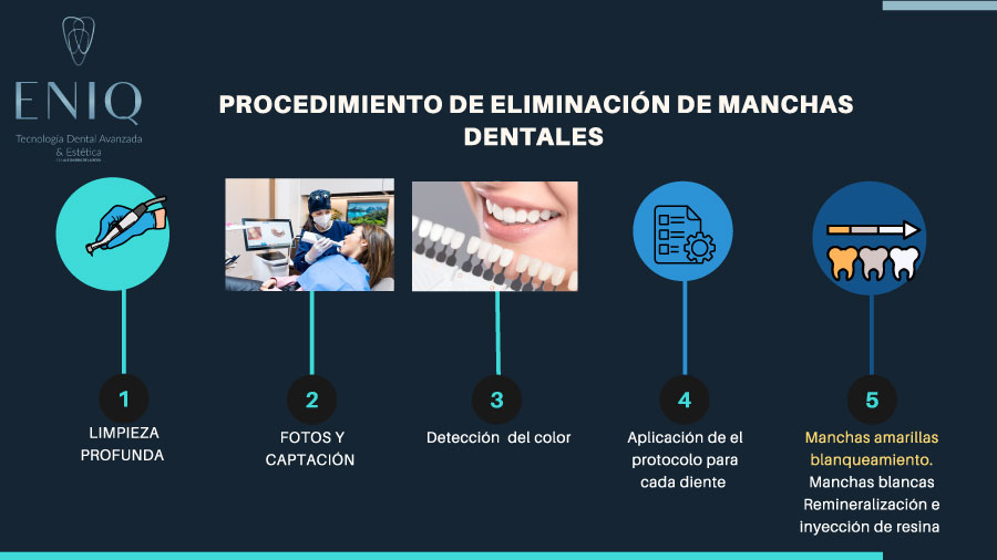 Procedimiento para la eliminación de manchas dentales