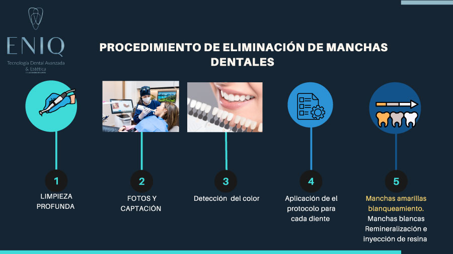 Procedure for the removal of tooth stains