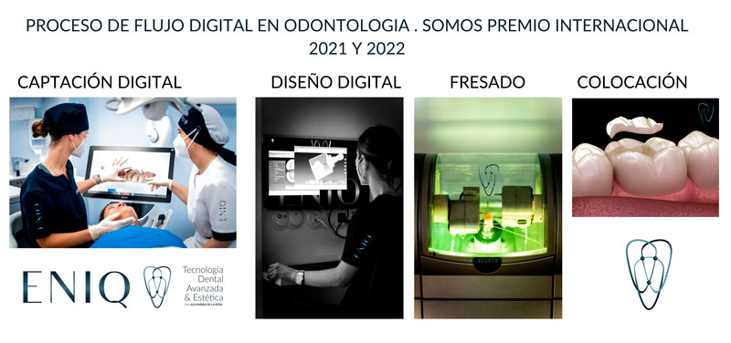 Explicación del proceso de captación digital para la incrustación dental