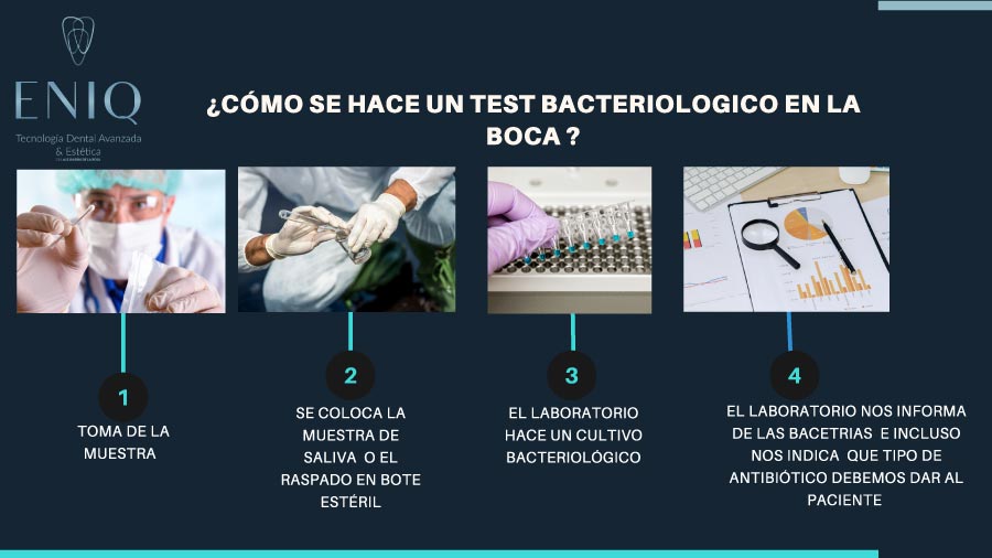 Procedimiento test bacteriológico bucal para el mal aliento