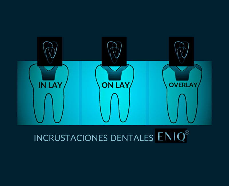 implantología en ENIQ