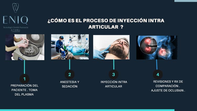 Procedimiento inyección intraarticular