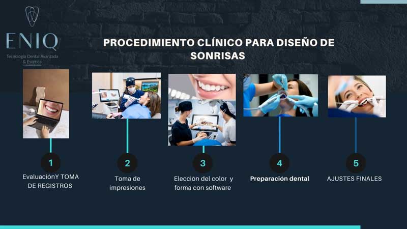 Clinical procedure for smile design
