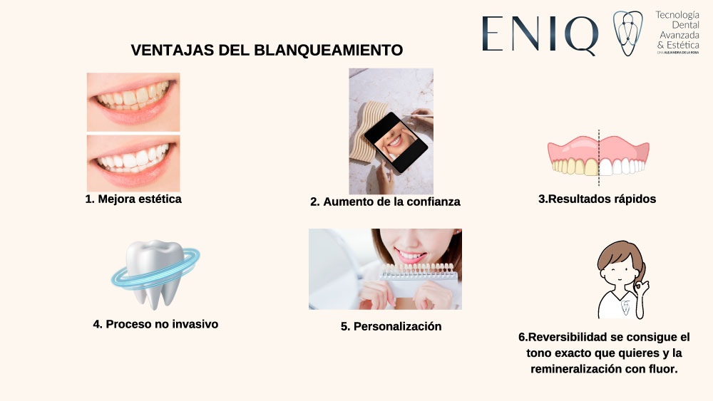 Explicación de las ventajas del blanqueamiento dental