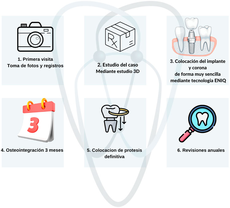 Explicación del proceso de un implante con carga inmediata