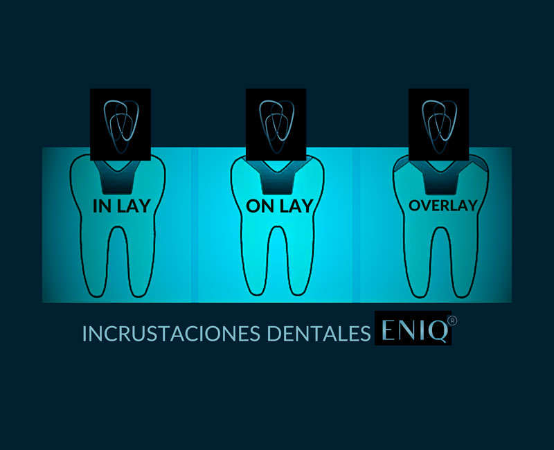 Tratamiento dental en ENIQ
